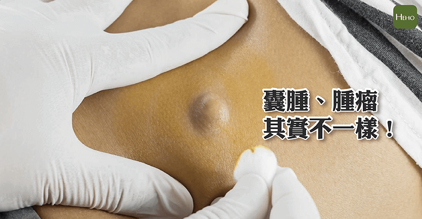 腫瘤-01